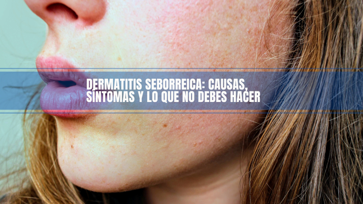Escamas y picazón en la piel: señales de dermatitis seborreica