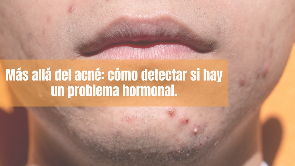 Tu piel no miente: señales de que necesitas un dermatólogo