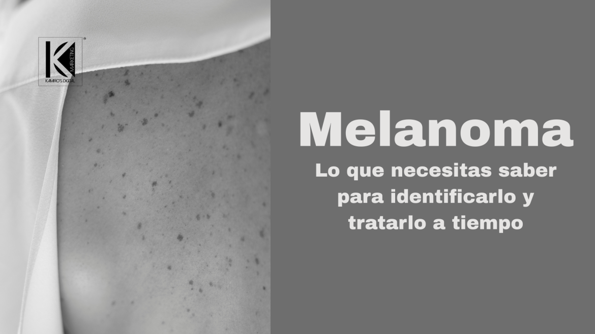 ¿Qué es el melanoma y cómo reconocer sus primeras señales?