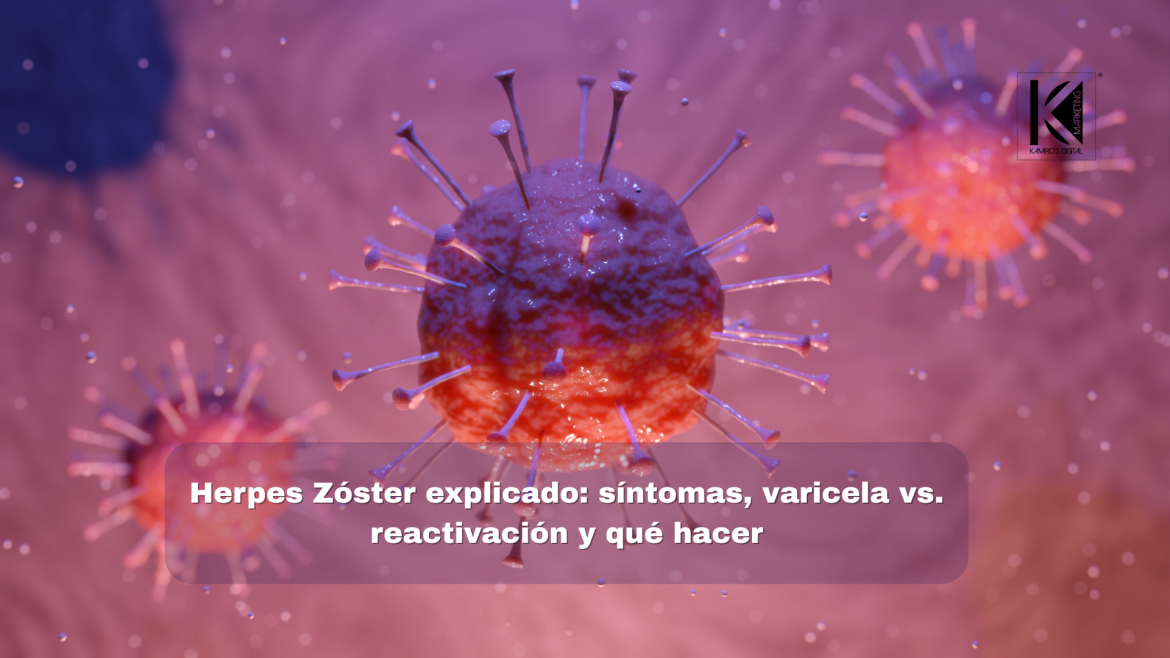 Evita el dolor prolongado: conoce el herpes zóster y su prevención